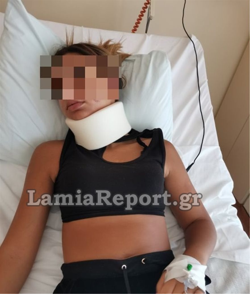 Λαμία: Άγριο ξύλο σε 13χρονη από τρεις 17χρονες – Την έστειλαν στο νοσοκομείο